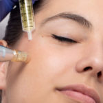 The Doctor Wellness Training Academy- Micro needling