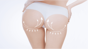 Butox,Bot-tox training, aesthetic training, doctor wellness london training hub