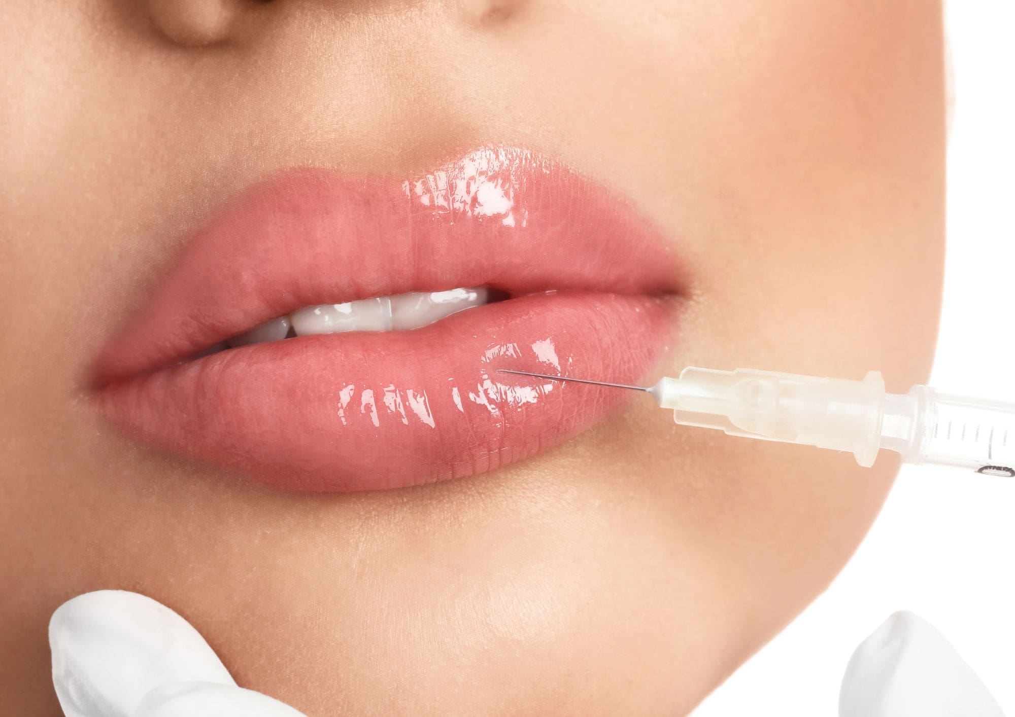 lip master class, Russian lips, dermal filler, aesthetic training, lips training, doctor wellness, london training hub